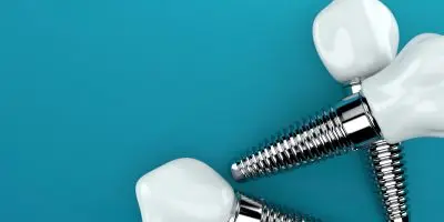 Icon style image for blog: Confused about dental implants?